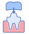 Prosthodontics Dentistry