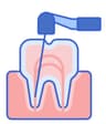 Endodontic Dentistry